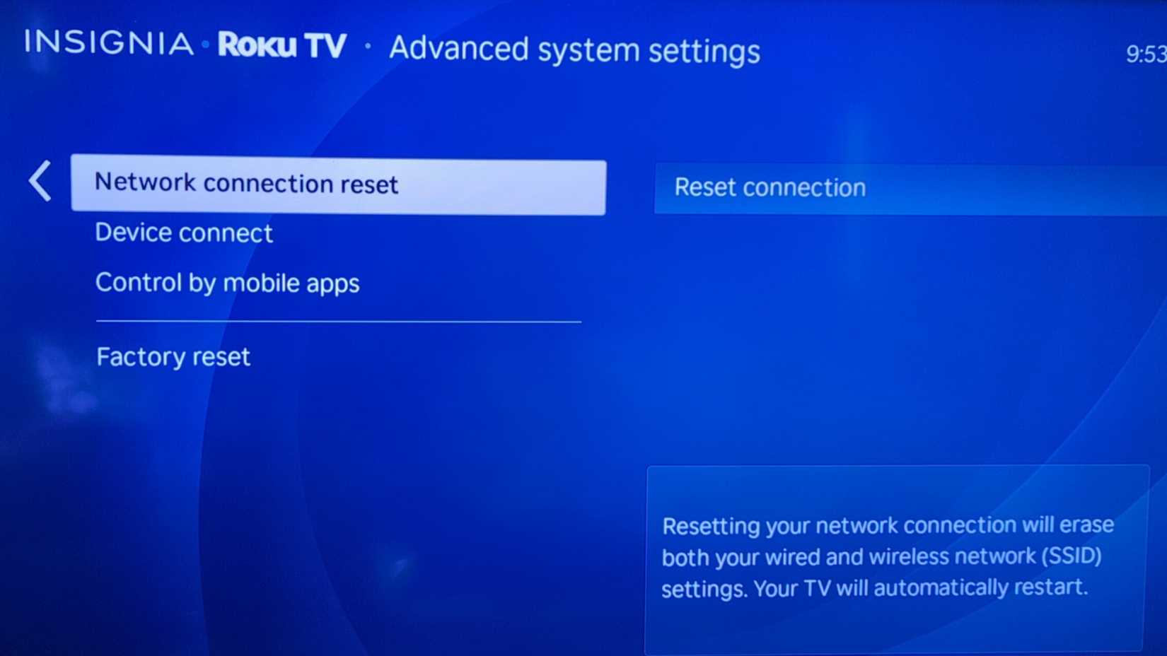 Advanced Roku How I Use My Roku TV Without Seeing Roku Ads